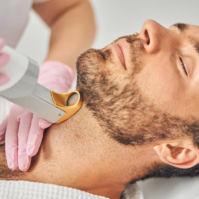 treating ingrown hairs on man's neck