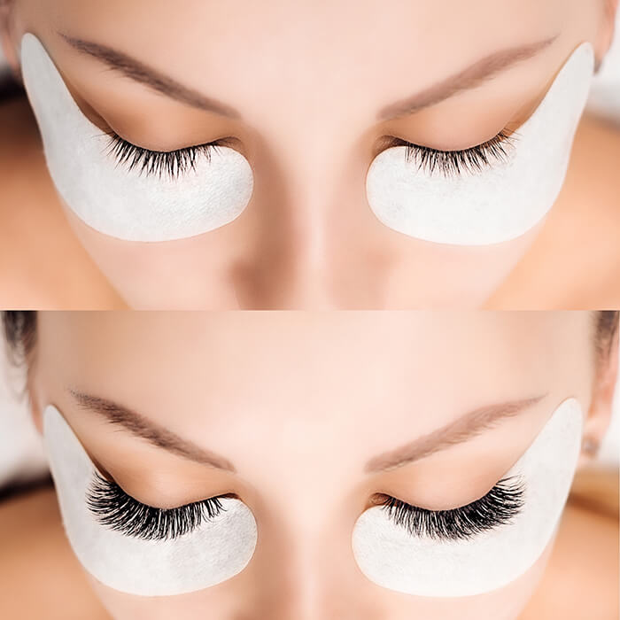 Before and After of eyelash extensions done at Encore Medical