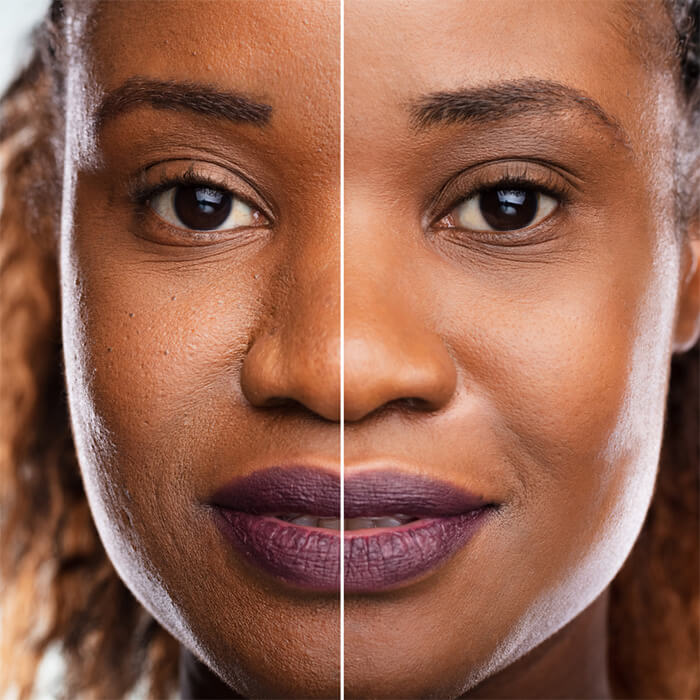 Black woman shows her before and after skin treatment