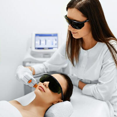 woman get freckles treated with photofacial in Edmonton